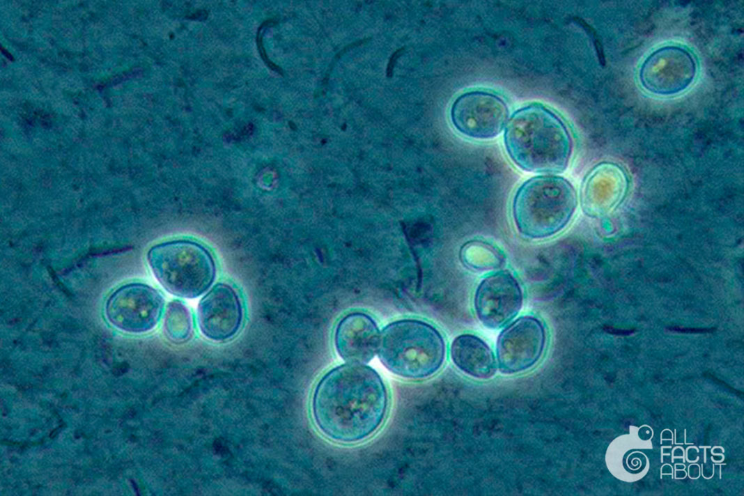 Yeast (look like under a microscope)